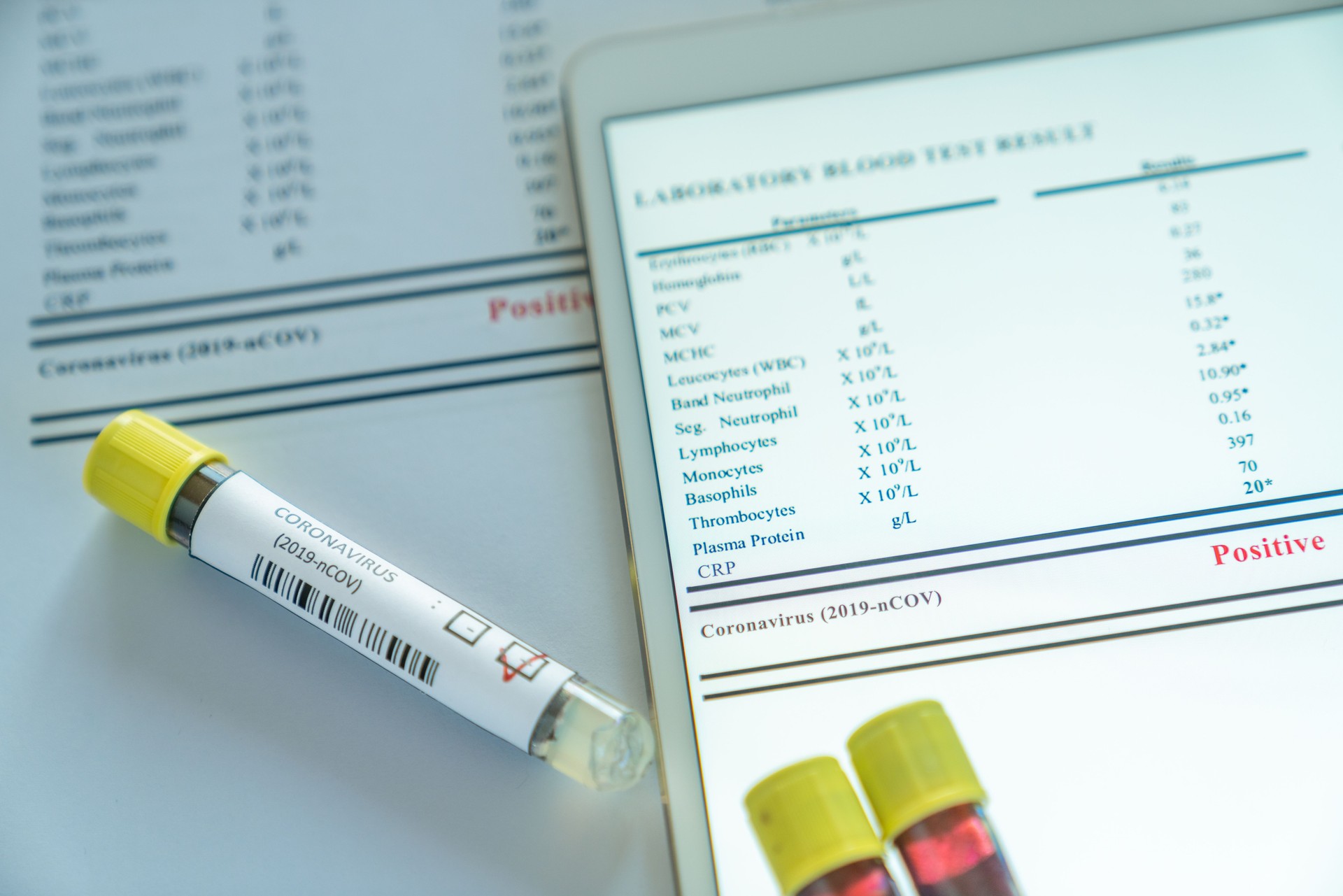 coronavirus blood test