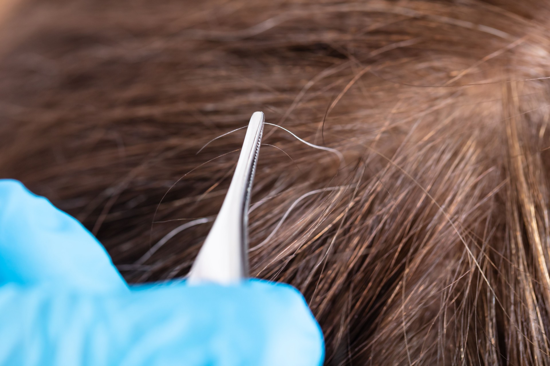 Hand Plucking Gray Hair With Tweezers